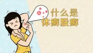 皮肤癣不治疗会自己好吗